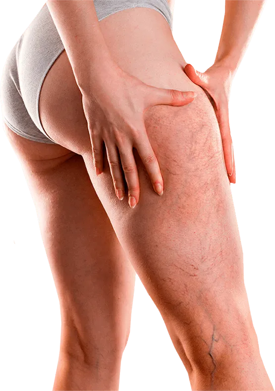 Veniselle - Formula avansată